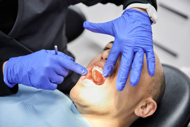 Best Emergency Treatment for Toothache in Seaside, CA